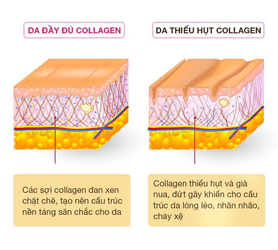 Cách xóa rãnh cười râu rồng hiệu quả hiện nay