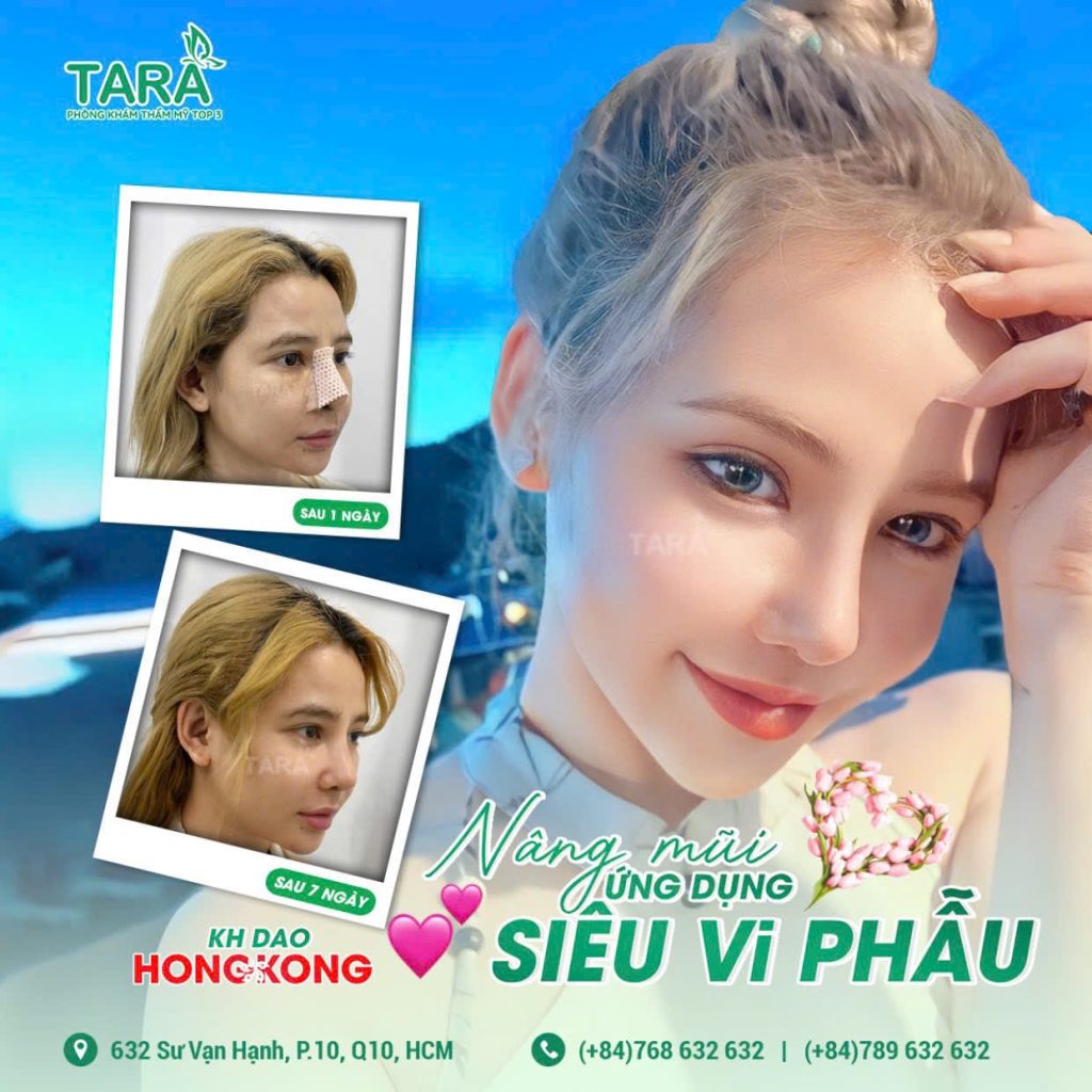 Review nâng mũi bác sĩ Trang: Đẹp và chất lượng