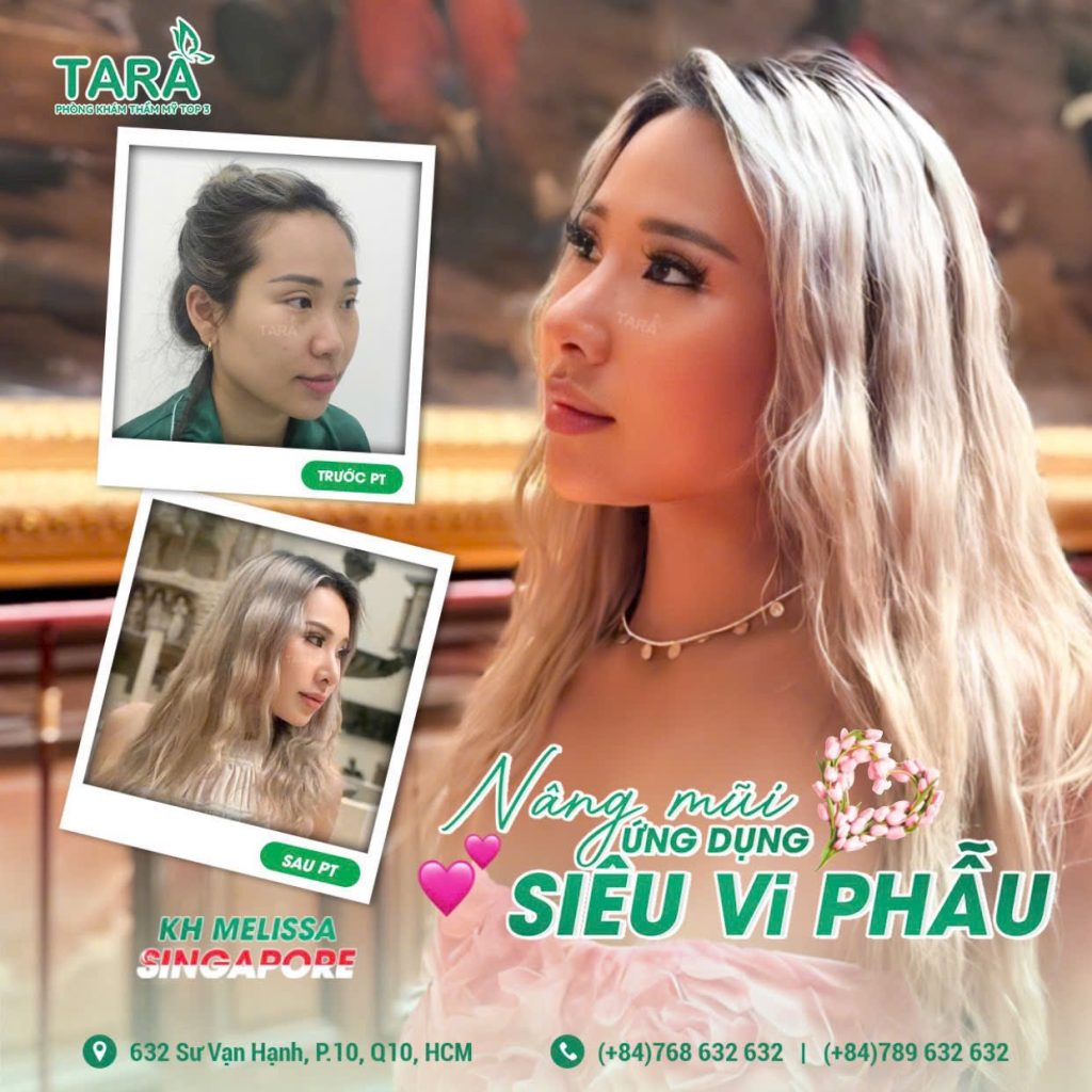 Review nâng mũi bác sĩ Trang: Đẹp và chất lượng