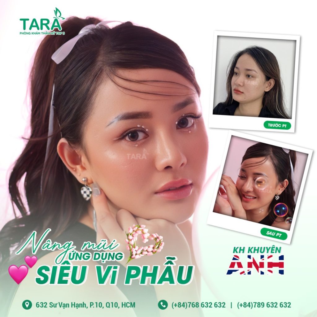 Review nâng mũi bác sĩ Trang: Đẹp và chất lượng