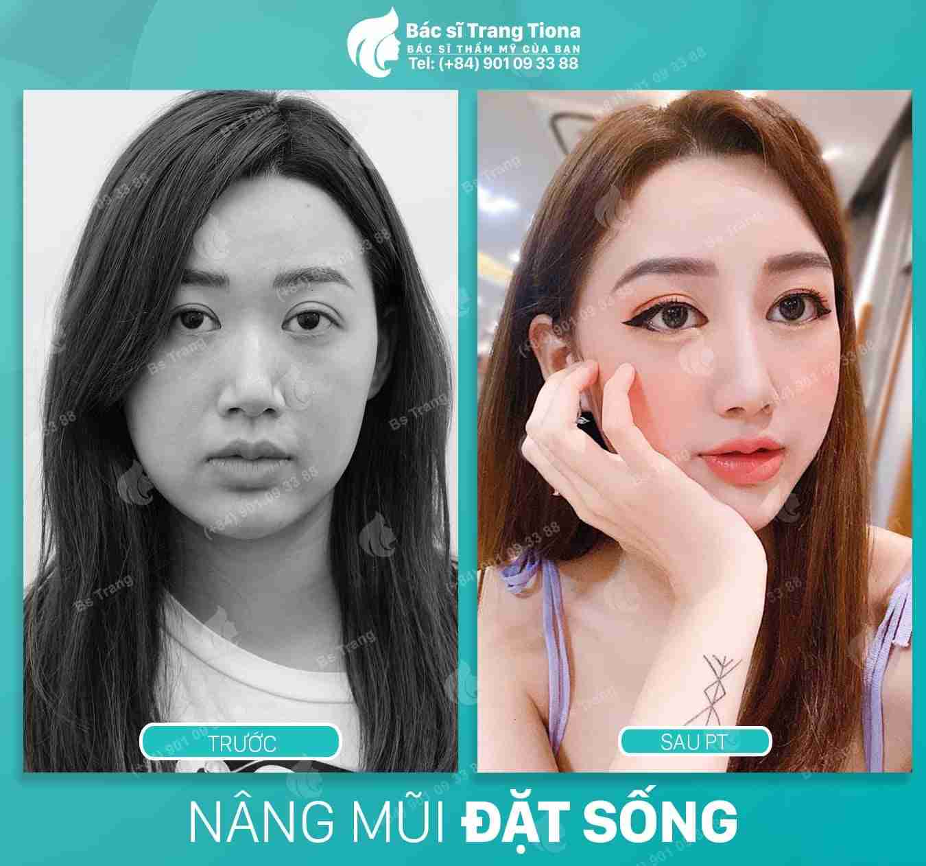 Sự thật về 5 tướng mũi giàu giúp bạn thành công?