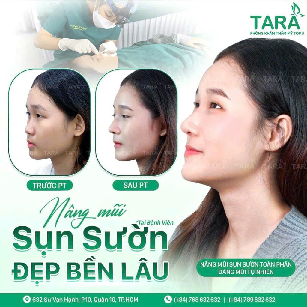 Bác sĩ giải đáp: Sửa mũi bằng sụn sườn có để lại sẹo ở ngực không?