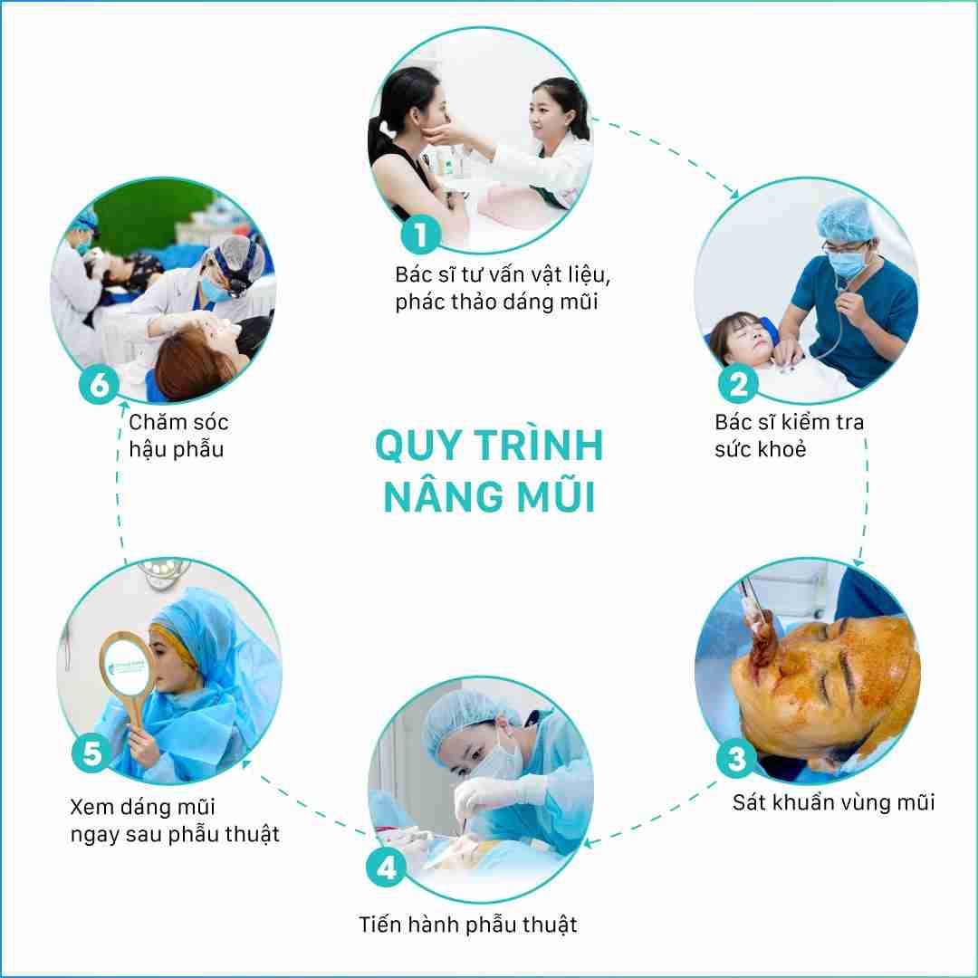 Sửa Mũi Hỏng Sau Phẫu Thuật