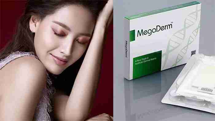 Sụn Megaderm có tốt không? Có gây biến chứng không?