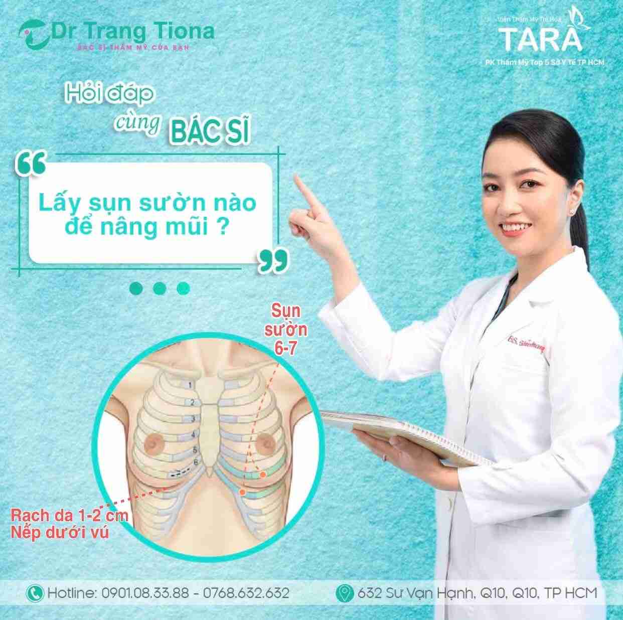 Sụn sườn được lấy từ đâu để nâng mũi?