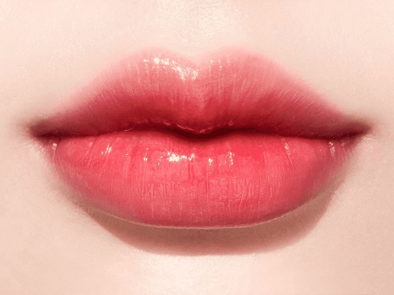 PHẪU THUẬT TẠO HÌNH MÔI TRÁI TIM – GIẢI PHÁP MỚI CHO ĐÔI MÔI QUYẾN RŨ