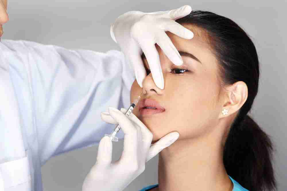 Giải đáp: Tháo sụn mũi xong bị lõm thì phải làm sao?