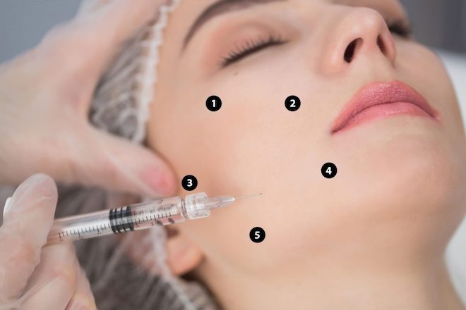 Từ A-Z về tiêm trẻ hoá da bằng kỹ thuật tiêm BAP