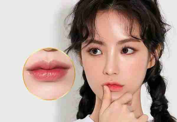 Tiêm filler môi có nên không? Giá bao nhiêu?