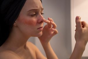 Tiêm filler ở spa bình thường có an toàn không? Có cần bác sĩ thực hiện không?