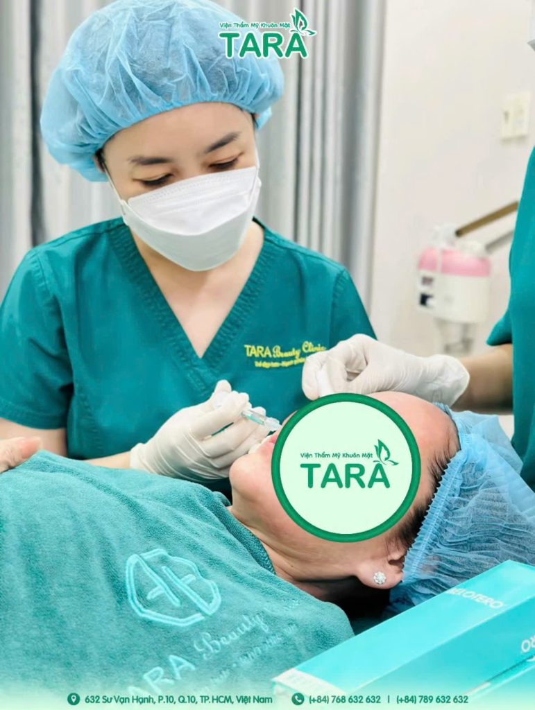 Tiêm fullface trước Tết: nên làm trước bao lâu để tự tin đi chơi?