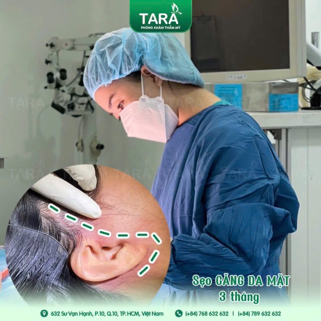 Timeline hồi phục sau phẫu thuật căng da mặt
