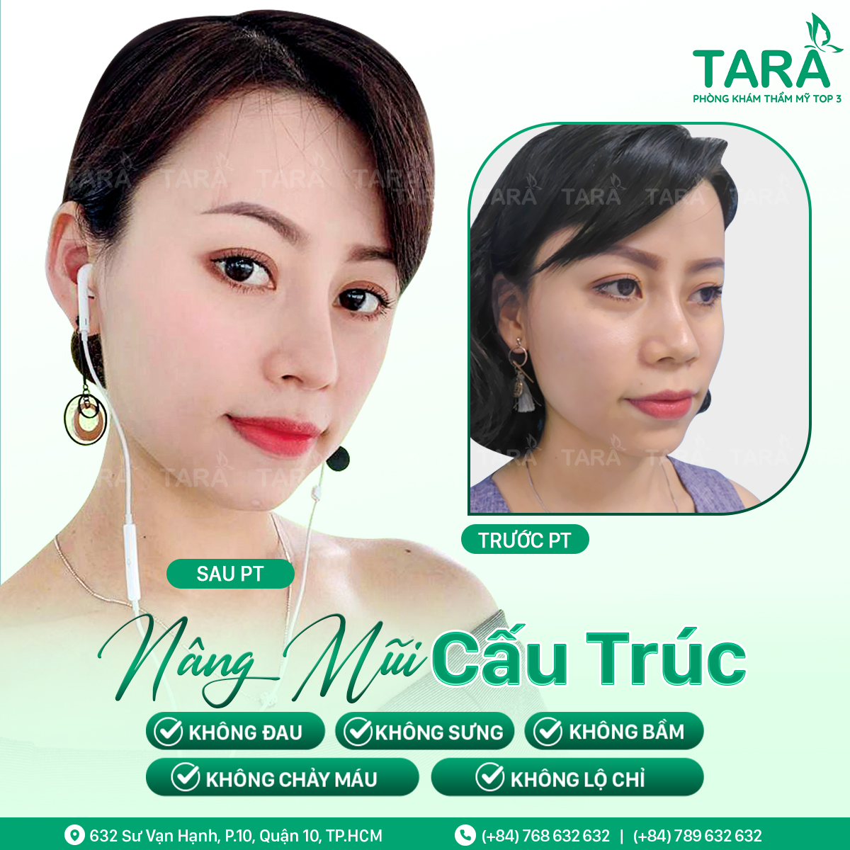 Bác sĩ nâng mũi đẹp uy tín tại TPHCM – Bác sĩ Trang Thẩm mỹ TARA
