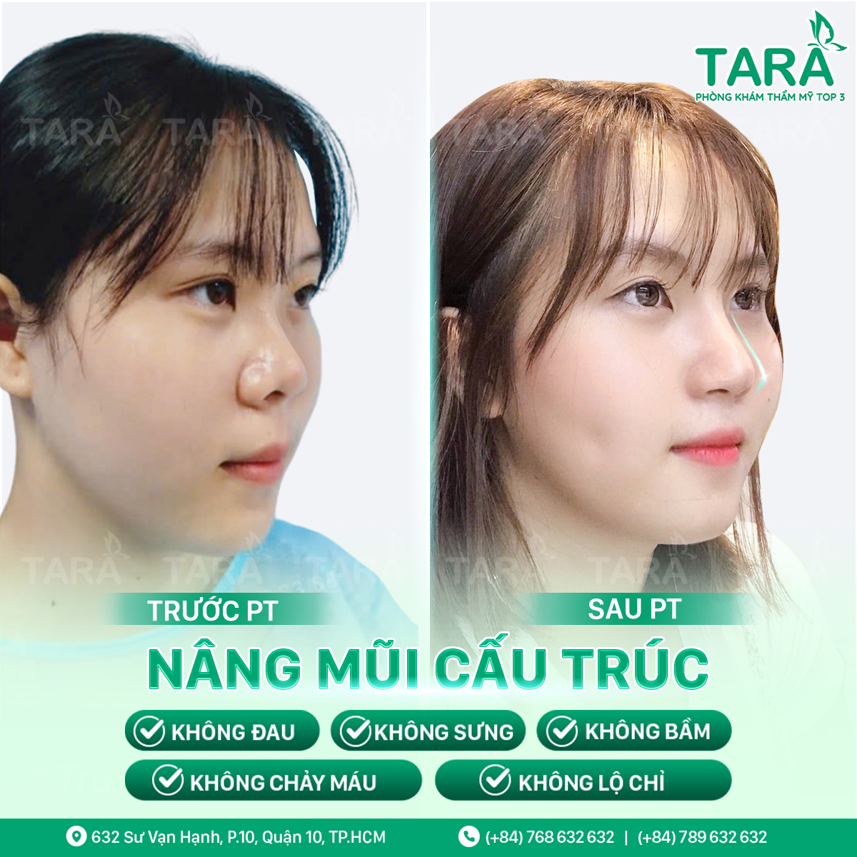 Bác sĩ nâng mũi đẹp uy tín tại TPHCM – Bác sĩ Trang Thẩm mỹ TARA