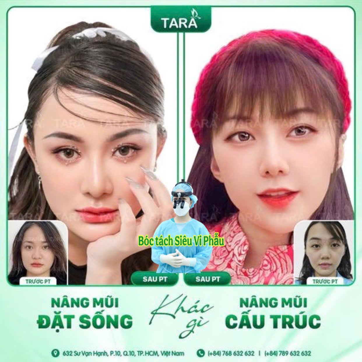 Bác sĩ nâng mũi đẹp uy tín tại TPHCM – Bác sĩ Trang Thẩm mỹ TARA