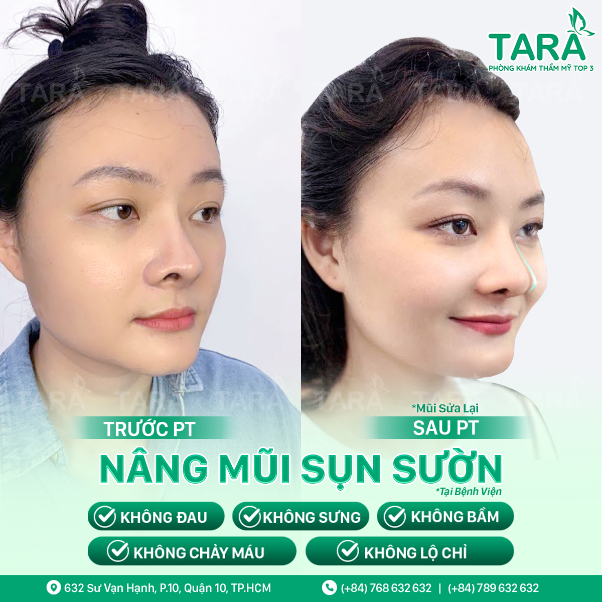 Bác sĩ nâng mũi đẹp uy tín tại TPHCM – Bác sĩ Trang Thẩm mỹ TARA