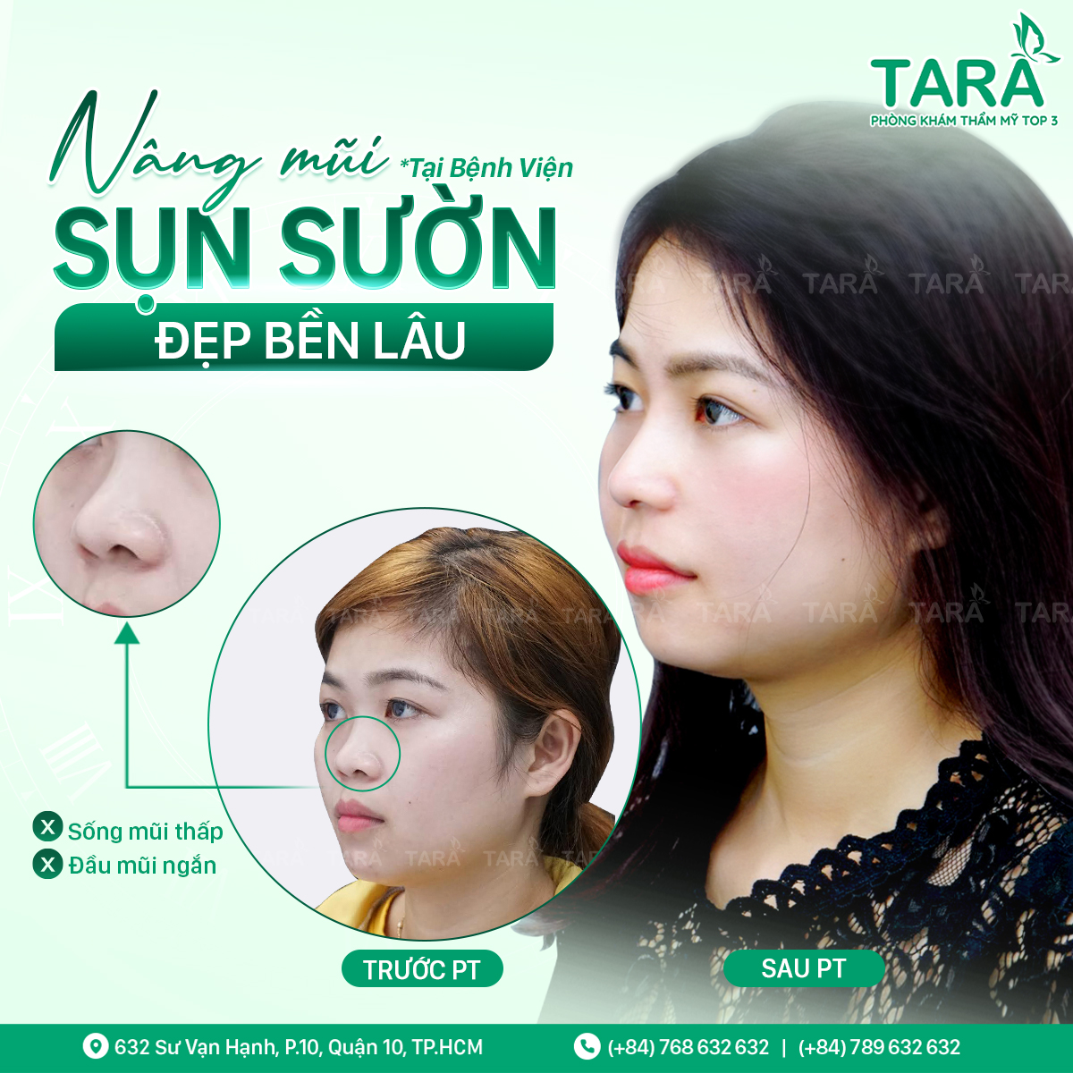 Bác sĩ nâng mũi đẹp uy tín tại TPHCM – Bác sĩ Trang Thẩm mỹ TARA