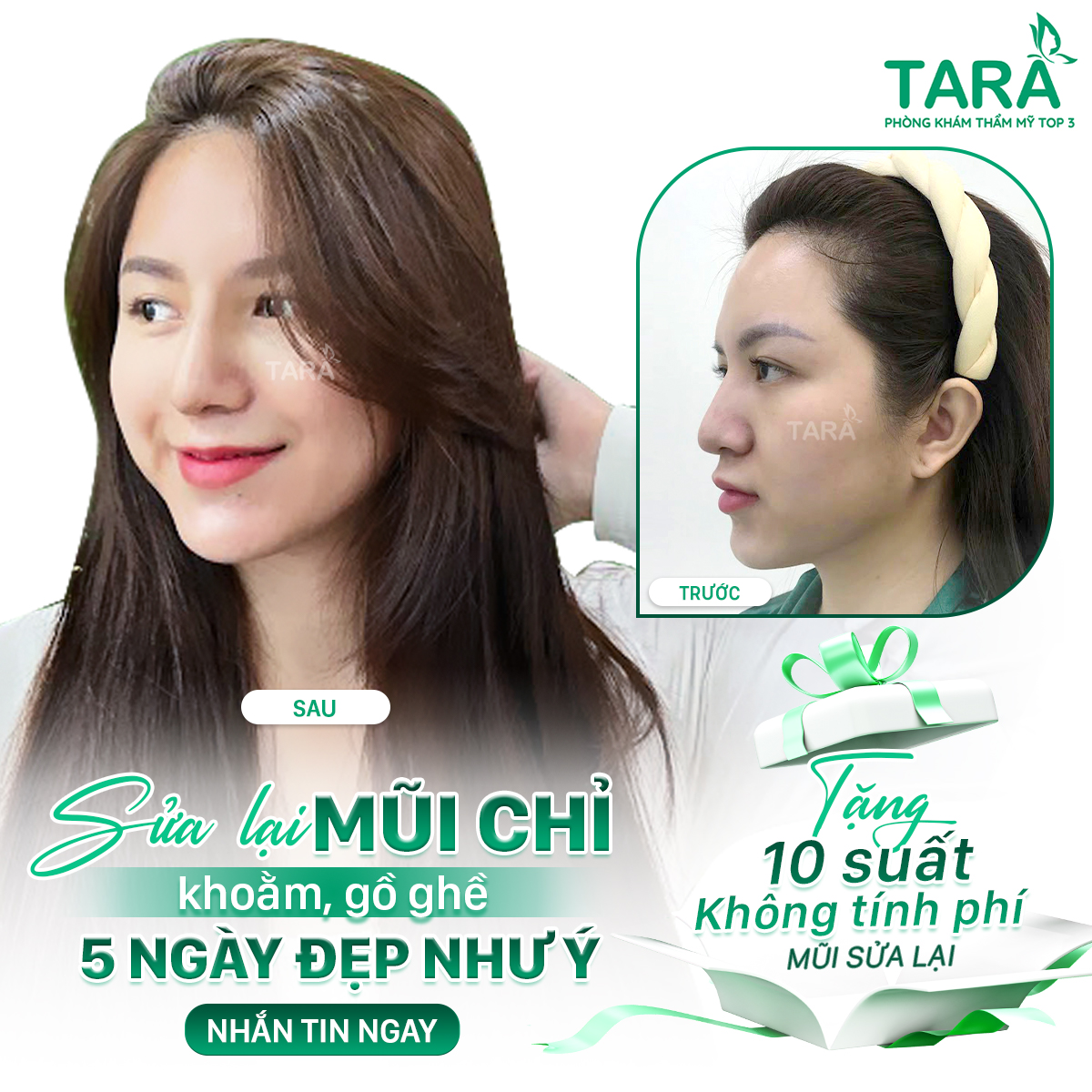 Địa chỉ nâng mũi đẹp uy tín tại TP HCM – Tiến sĩ Bác sĩ Trang Thẩm mỹ TARA – Dr Trang TARA