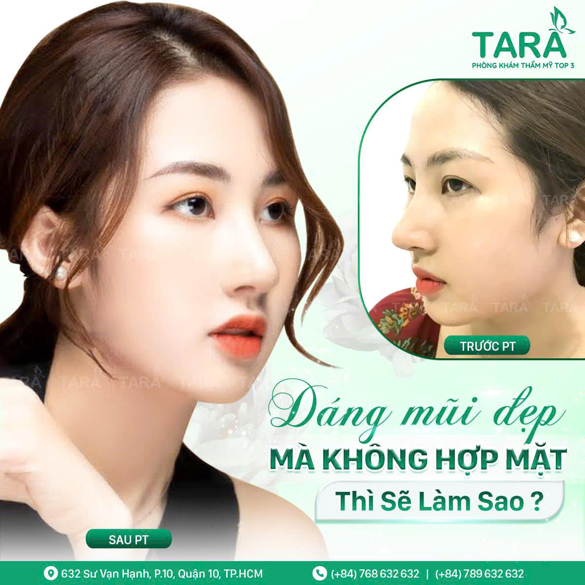 Địa chỉ nâng mũi đẹp uy tín tại TP HCM – Tiến sĩ Bác sĩ Trang Thẩm mỹ TARA – Dr Trang TARA