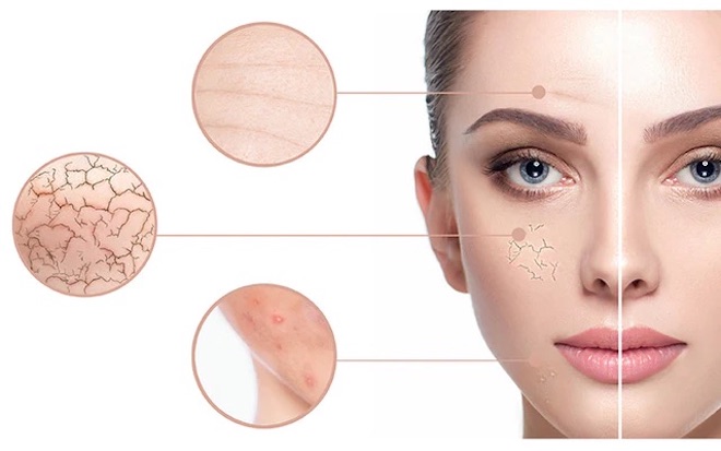 Hướng dẫn vệ sinh da mặt sau khi tiêm căng bóng trẻ hoá da