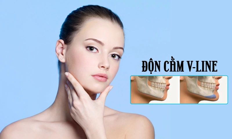 Hướng dẫn vệ sinh tại nhà sau khi độn cằm đúng cách